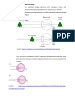 -2. Detail Pertemuan_Penyebab Kelainan Mata