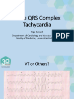 Yoga Yuniadi - Wide QRS Complex Tachycardia - Baru