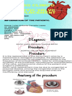 Caso Clinico Aortic Valve Replacement: Procedure: Procedure