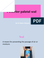 Posterior Palatal Seal