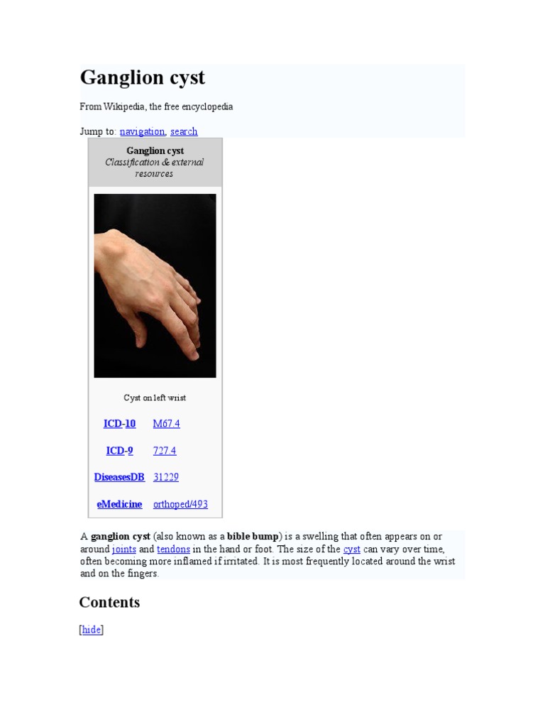 Ganglion Cyst | Musculoskeletal Disorders | Medicine