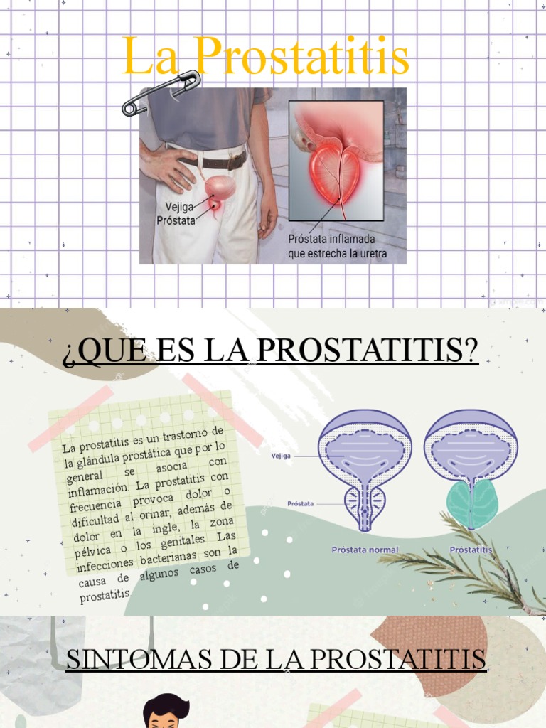 Prostatitis: Síntomas y Prevención | PDF | Enfermedades del sistema ...