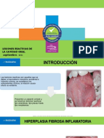 Lesiones reactivas de la cavidad oral: Hiperplasia fibrosa inflamatoria