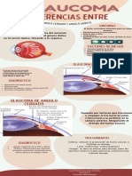 Glaucoma