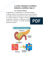 Diferencia Entre Diabetes Mellitus Tipo 1 y Diabetes Mellitus Tipo 2 - Lis