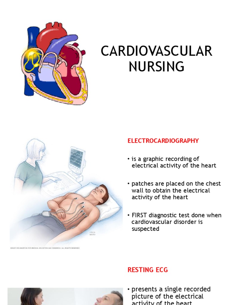 An Overview of Cardiovascular Assessment Techniques A Guide to the Diagnostic Tests and Nursing