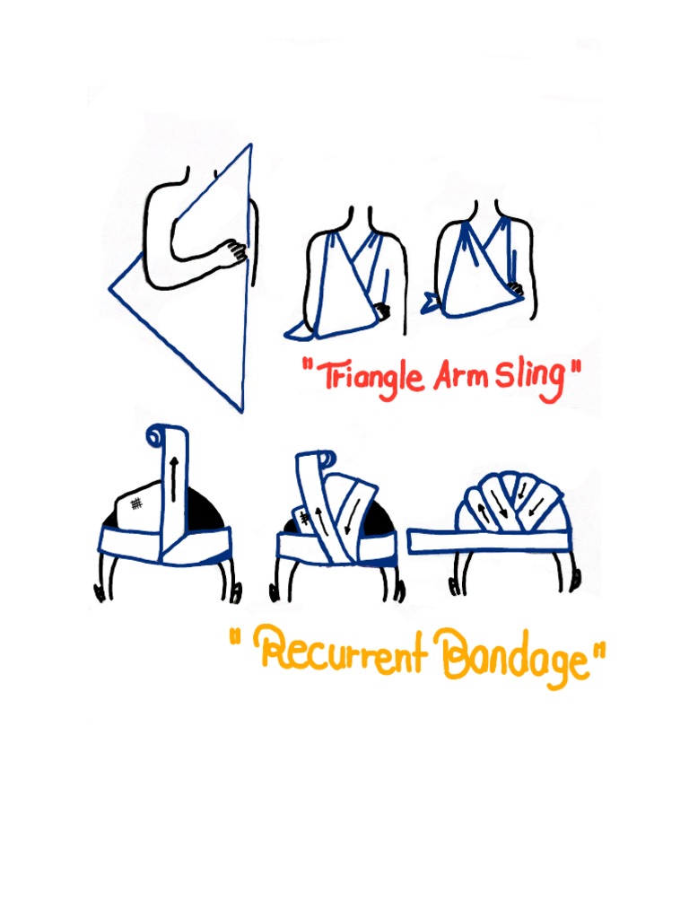 Triangle Arm Sling' PDF