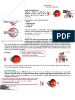 Oftamologia Tips de La Refraccion