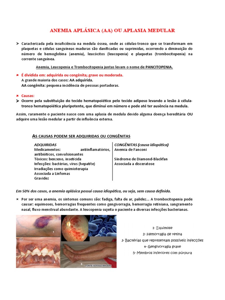 Anemia Aplástica | PDF | Anemia | Medula óssea
