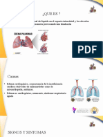 Edema Pulmonar