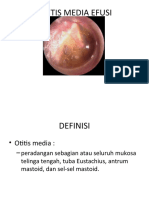 Otitis Media Efusi