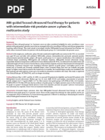 High Intensitnd Hifu Can Control Prostate Cancer Fewer Side Effects