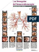 The Bronchus Through The Broncoscope - ES