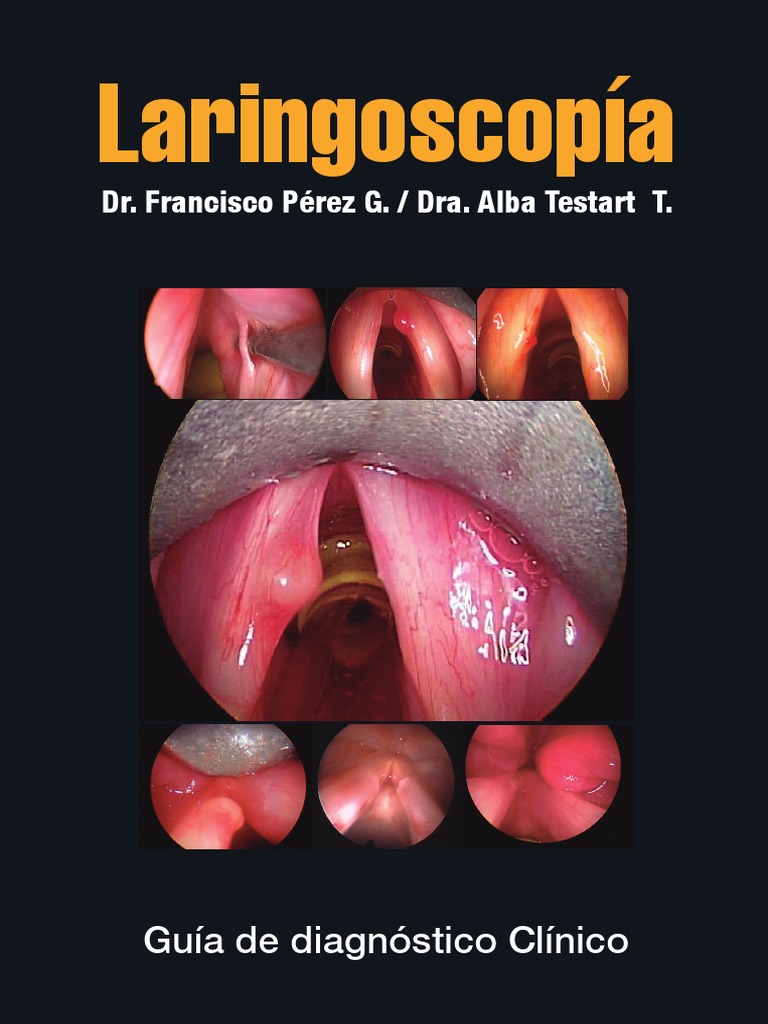 13 Laringoscopía Perez Testart | PDF | Laringe | Tos