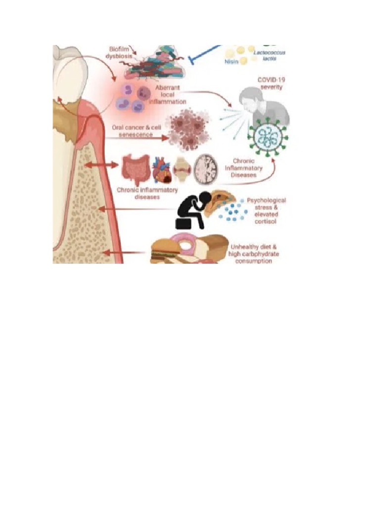 Enfermedad Periodontal | PDF