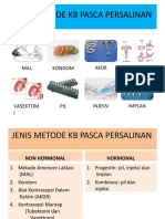 Jenis Metode KB Pasca Persalinan Akdr Tu