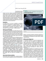 Ovarian Cyst