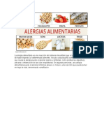 Alergias Alimentarias