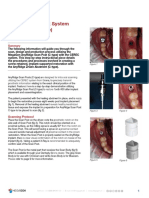 CEREC Case Insight Met Cerec