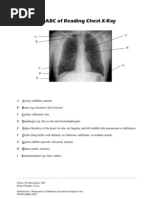 Chest X-Ray Interpretation Guide | PDF | Thorax | Lung