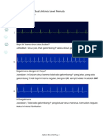 EKG Sesi 4 Latihan Soal Aritmia Level Pe