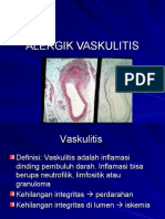Allergic Vasculitis
