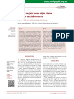 Queilitis Angular Como Signo Clínico Inicial de Una Tuberculosis