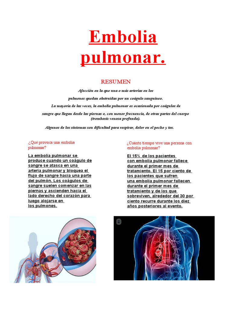 Embolia Pulmonar Pdf 2025 : L’embolie pulmonaire en pratique – WDAL