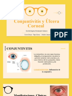 Conjuntivitis y ulcera corneal
