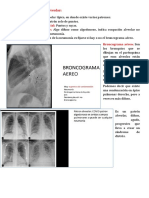 Todo Materia Neumo Final