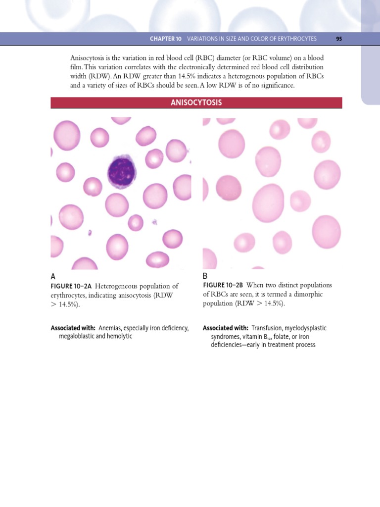 Anisocytosis and Erythrocyte Variations | PDF | Anemia | Red Blood Cell