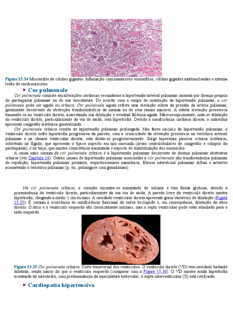 Cor Pulmonale e Cardiopatia Hipertensiva | PDF