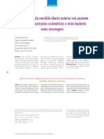 Compensação Da MAA em Paciente Vertical Com Extrações Assimétricas e Mini-Implante - DPress 2018