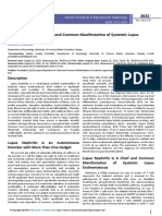 lupus-nephritis-is-a-chief-and-common-manifestation-of-systemic-lupus-erythematosus