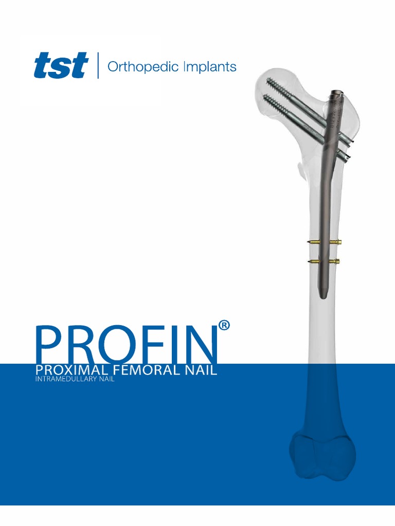 Femoral neck fracture: Proximal femoral nail (Synthes long TFNA) for  Intertrochanteric fracture-overview - OrthOracle, image size:768x1024