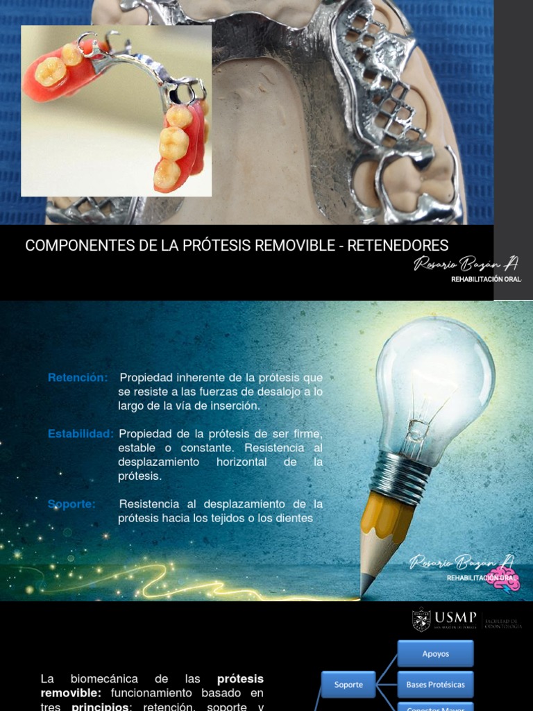 Teoria 6.componentes de La Ppr-Retenedores | PDF | Dentadura postiza ...