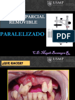 Paralelizado dental
