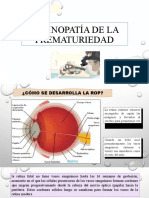 Retinopatia de La Prematuriedad