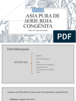 Aplasia Pura de Serie Roja Congénita