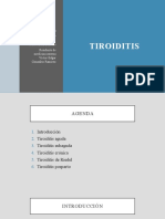 Guía sobre las diferentes tiroiditis: aguda, subaguda, crónica y de Riedel