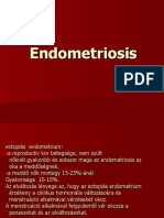 22 Endometriosis