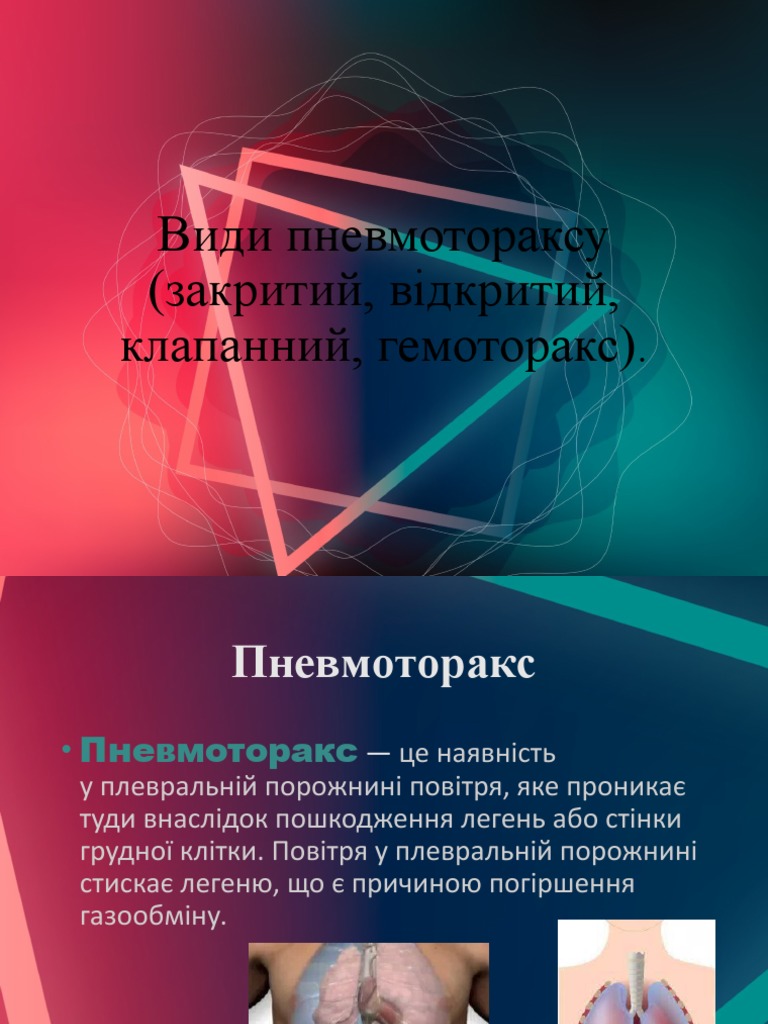Пневмо- Гемоторакс | PDF