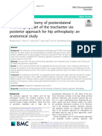 Modified Osteotomy of Posterolateral Overhanging Part of The Trochanter Via Posterior Approach For HA An Anatomical Study