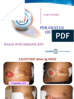 Ostomy Case Study