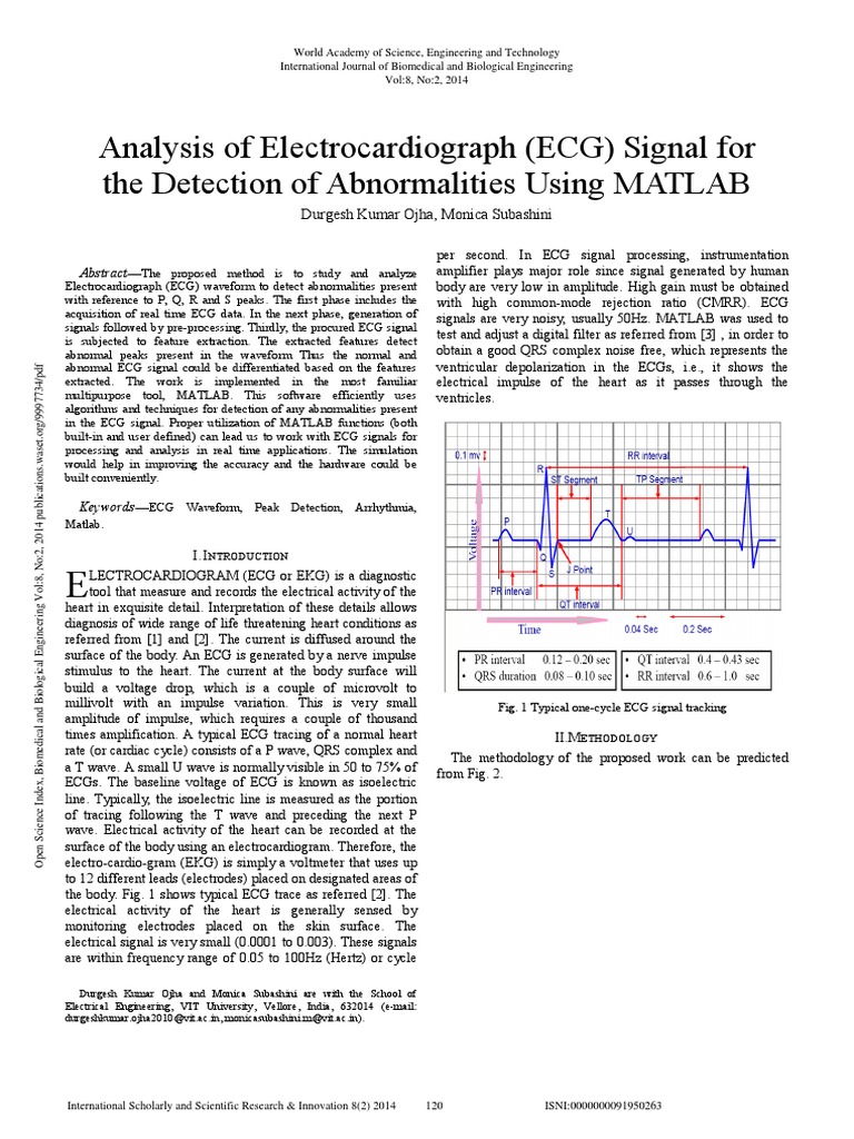 Analysis of Electrocardiograph Ecg Signal For The Detection of ...