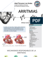 Arritmias