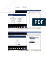 1) Semiología Torácica y Pulmón