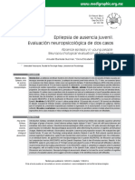 Epilepsia Ausencias Juvenil