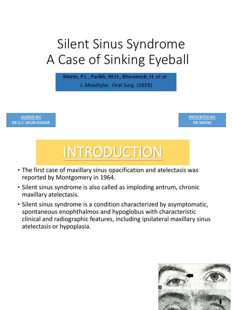 Silent Sinus Syndrome PDF Causes Of Death Human Head And Neck