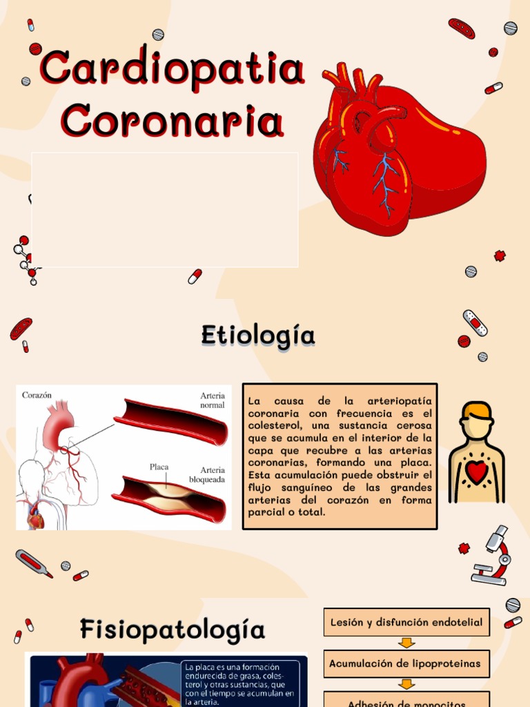 Cardiopatia Coronaria | PDF | Infarto de miocardio | Causas de la muerte